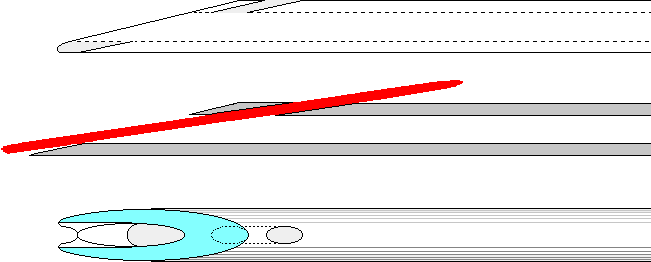 Needle Modifications, second revision